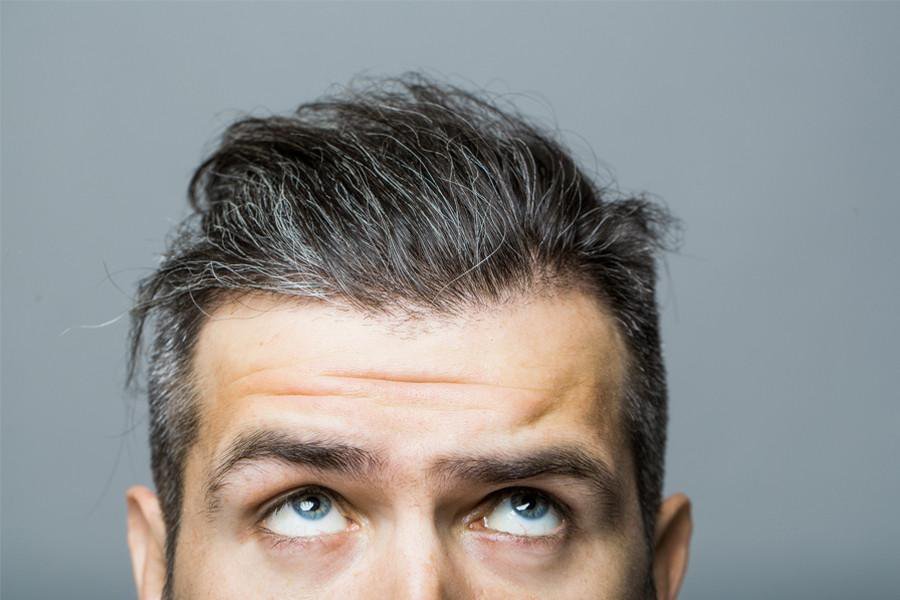 Could Diet Remedy Going Grey Prematurely?
