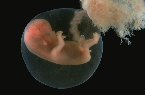Congress Calls For An End Of Using Aborted Humans For Spare Parts In Medicine and Vaccines