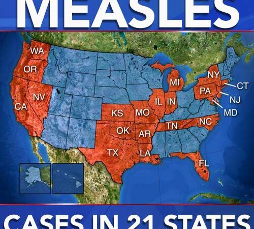 2018 Measles “Outbreak”