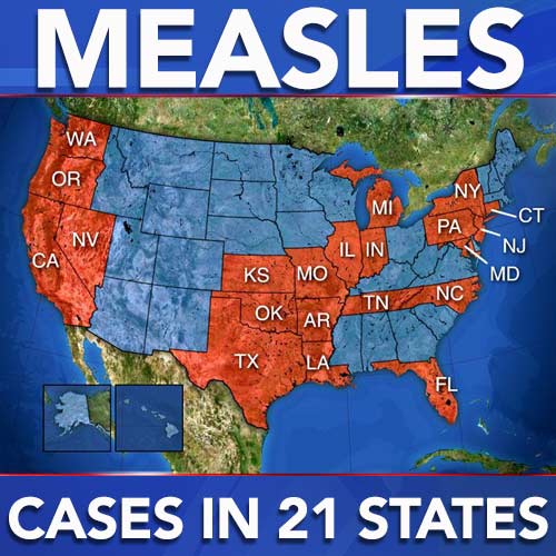 2018 Measles “Outbreak”